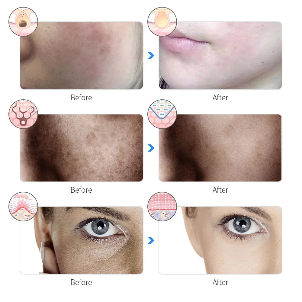 7-Color LED Photon Therapy Face Mask