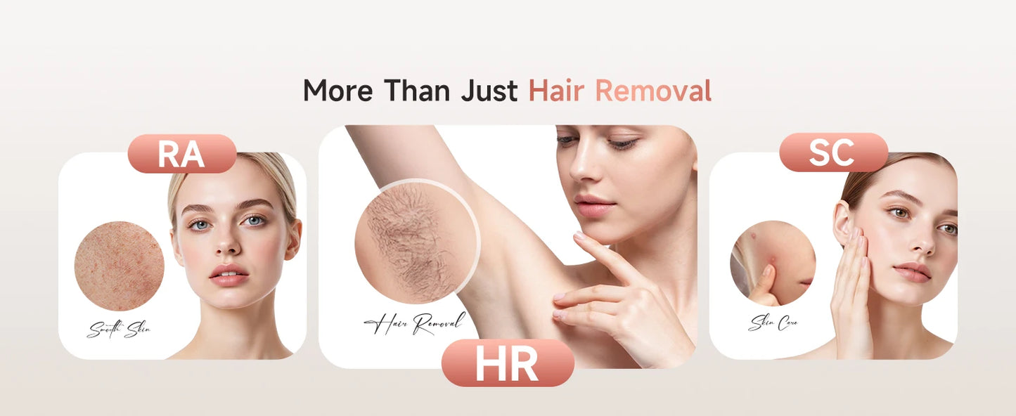 IPL Hair Removal Device — 999,900 Flashes