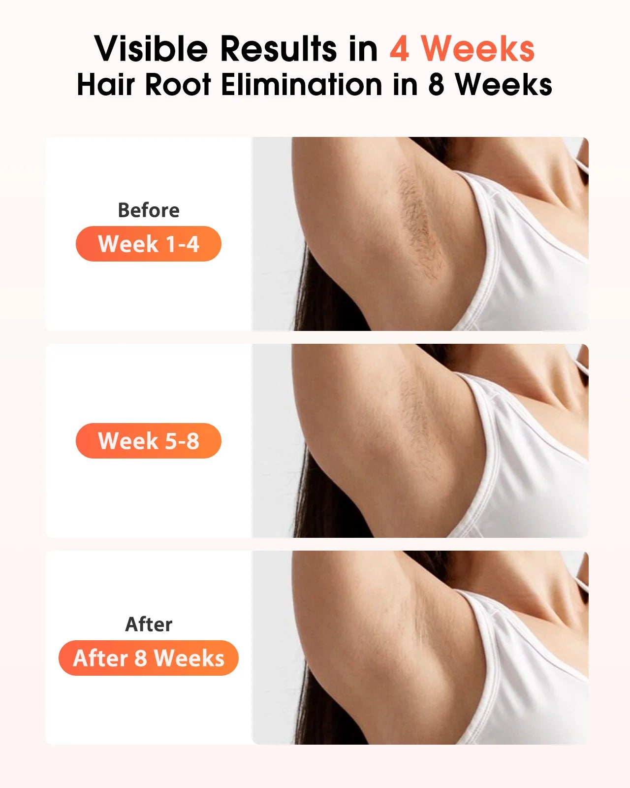 IPL Hair Removal Device — 999,900 Flashes