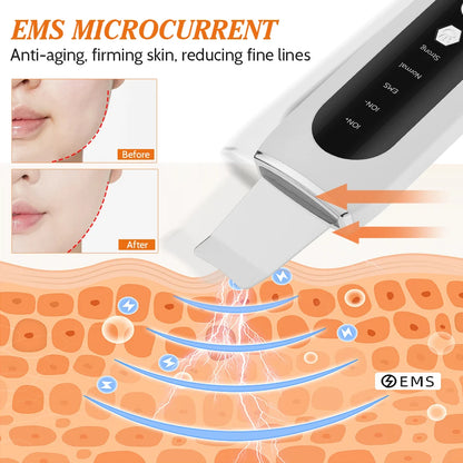5-in-1 Ultrasonic Skin Scrubber & LED Facial Cleansing Device
