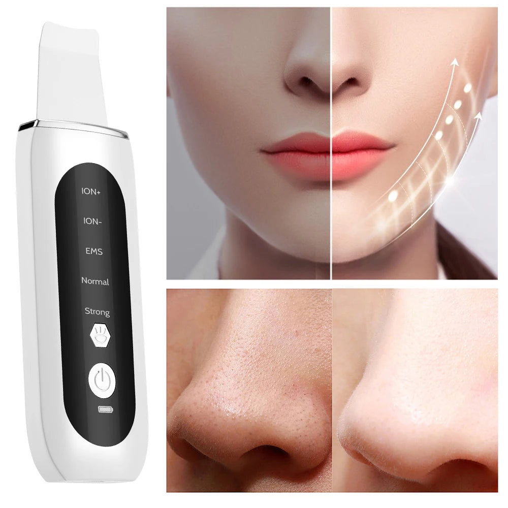 5-in-1 Ultrasonic Skin Scrubber & LED Facial Cleansing Device