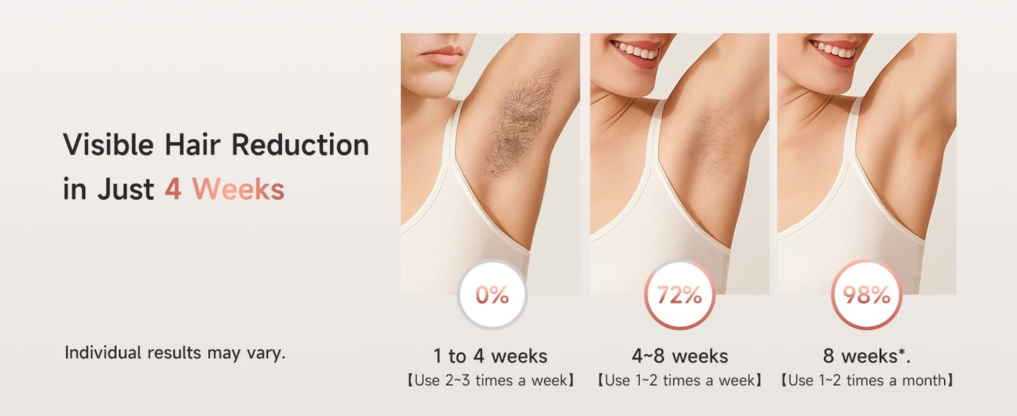 IPL Hair Removal Device — 999,900 Flashes